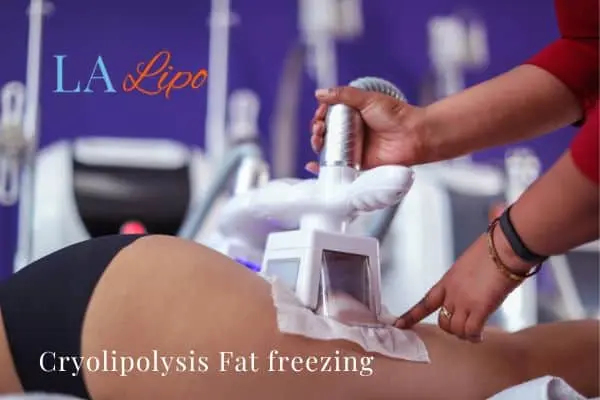 women getting fat freezing Merthyr Tydfil