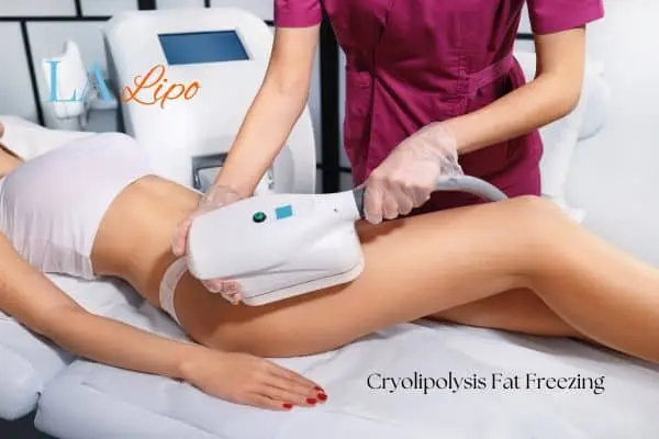 Woman receiving coolsculpting Merthyr Tydfil treatment on her thighs