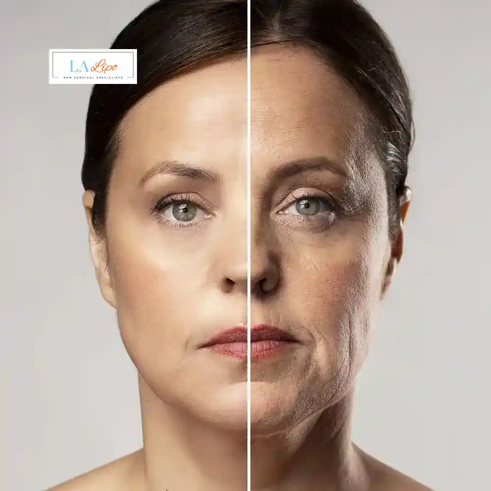 How Can You Tell If Non-Surgical Skin Tightening Is Right for You Merthyr Tydfil?