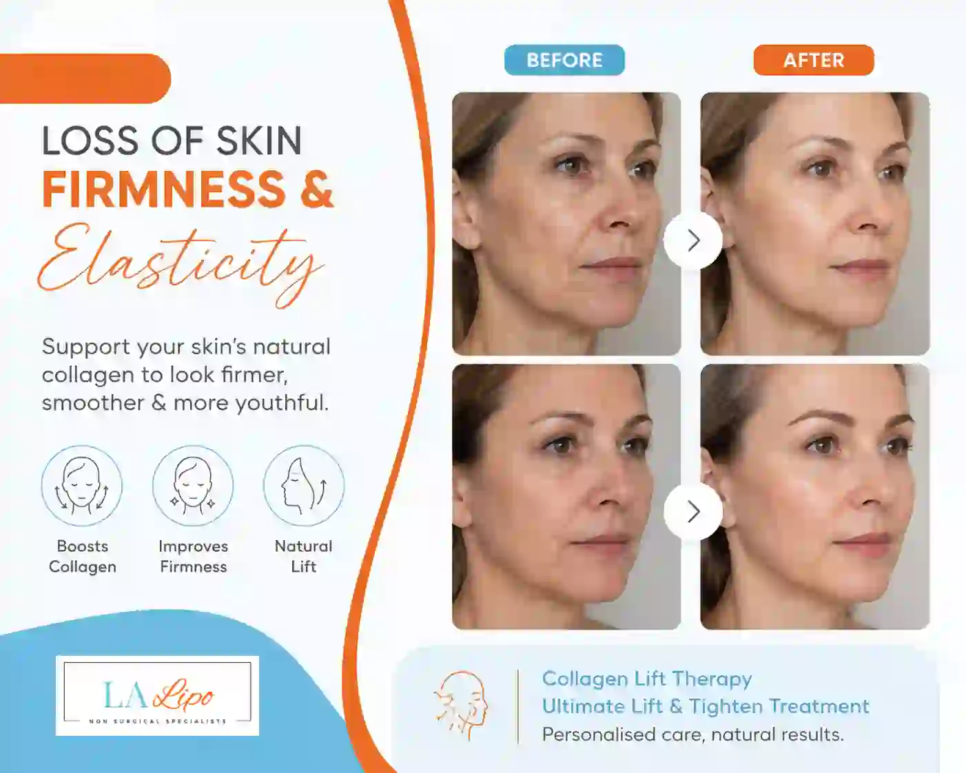 Sign #7: Loss of Skin Firmness and Elasticity Merthyr Tydfil
